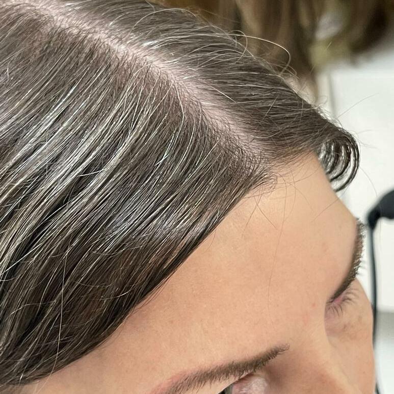 Custom Human Hair Hand Tied Form Fitted to Client.  Color Highlights to Spec.  Medical wig cranial prosthesis